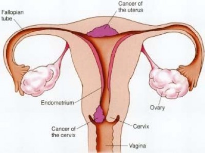 Tử cung - Bệnh tử cung ở phụ nữ là gì?