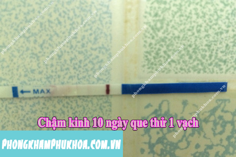 Chậm kinh 10 ngày que thử 1 vạch Chậm kinh 10 ngày que thử 1 vạch