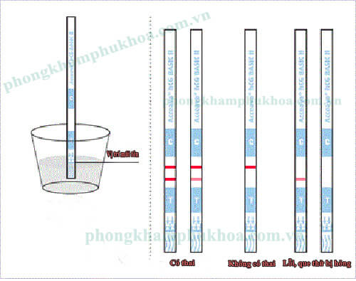 Cách sử dụng que thử thai đúng cách Cách sử dụng que thử thai đúng cách