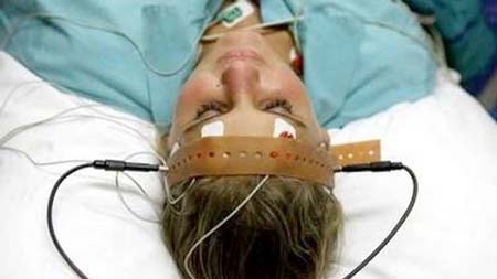 Giang mai gây ảnh hưởng đến hệ thần kinh